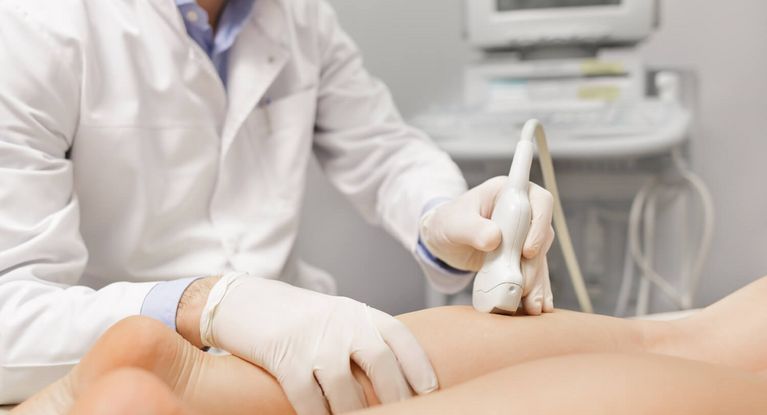 Gefäßchirurgie Untersuchung der Gefäße